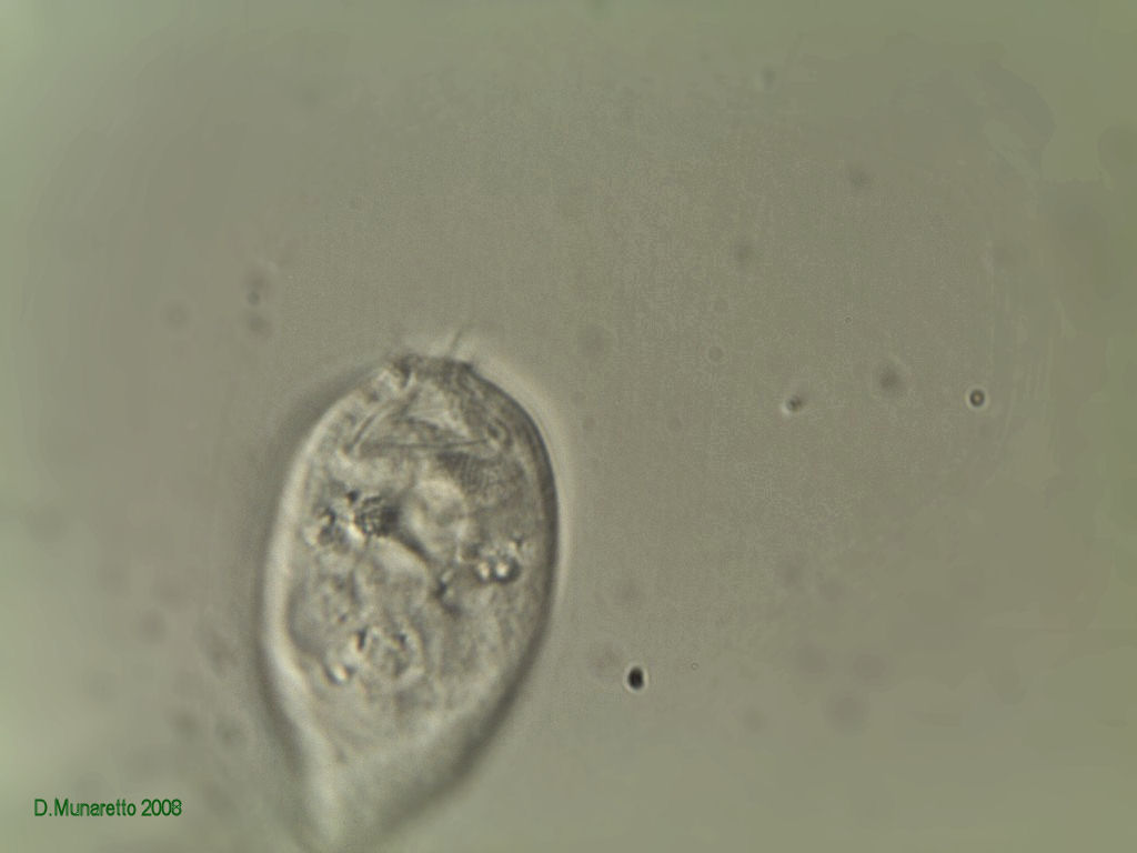 Vorticella in varie fasi di apertura